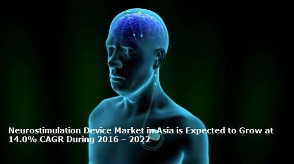 Neurostimulation Device Market Size, Share, Growth and Demand, 2022