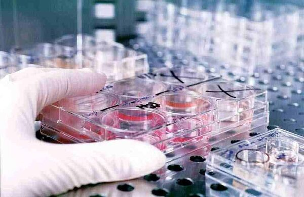 Об участии в международных сличительных испытаниях микробиологов ИЦ ФГБУ «ВНИИЗЖ»