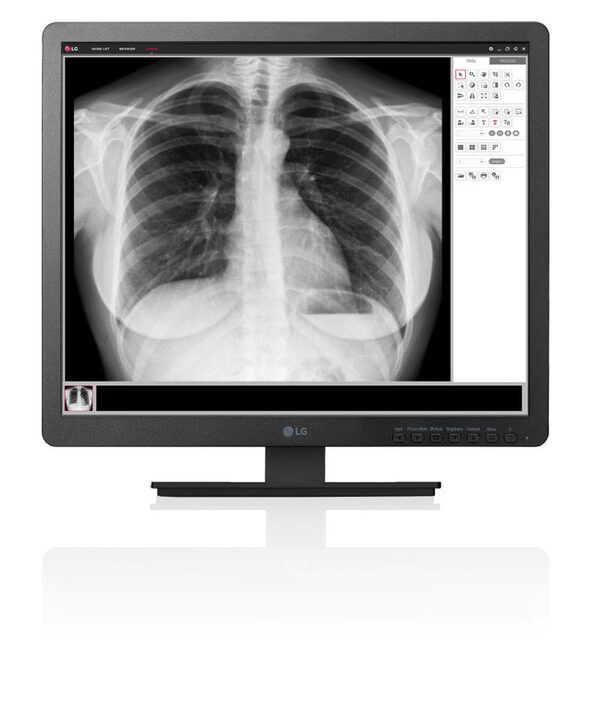 LG           Medica 2017