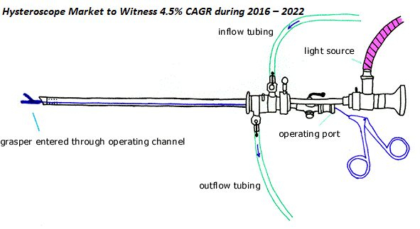 Hysteroscope Market by Key Trends and Analysis, 2022