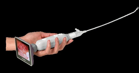 Hysteroscope Market Emerging Growth, Drivers and Trends Analysis with Forecasted Report