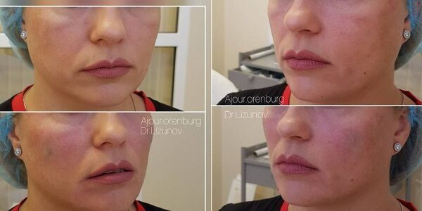 ��� �������� ���������