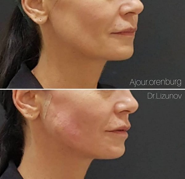 ���� ��������������� �����