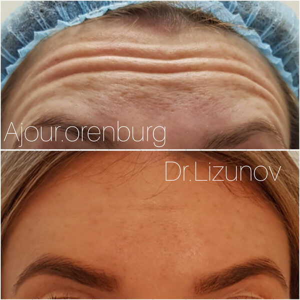 ��������� ��������� ���������� ������