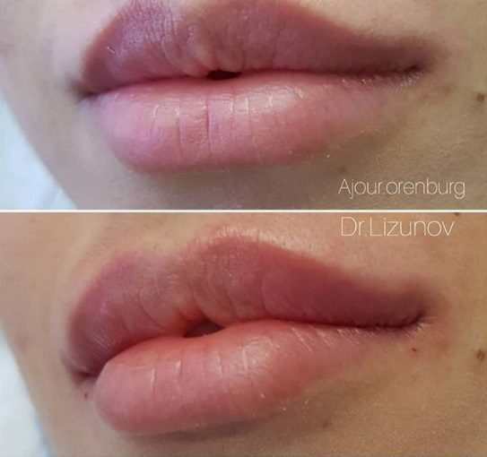 ���������� ���