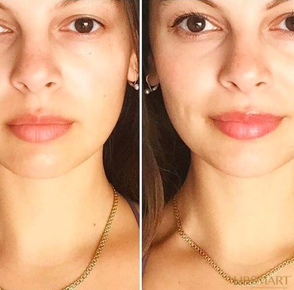 Lipsmart    