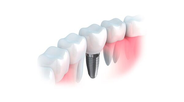       BrainMark Dental Studio