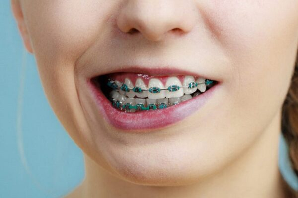 ������ �������� �� ������������ ������� �������� �� �������� ��������