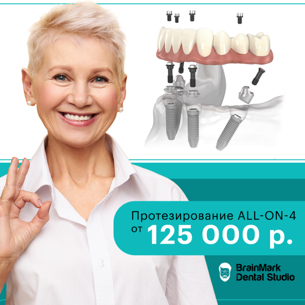   All-on-4  BrainMark Dental Studio