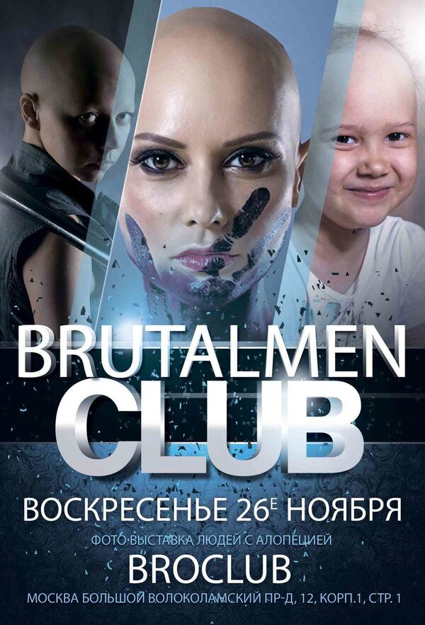 Первая в России фотовыставка людей с алопецией Первая в России фотовыставка людей с алопецией