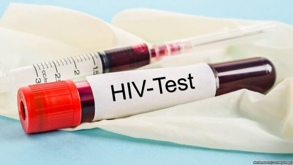 Increasing Prevalence of HIV/AIDS Drives the Global HIV Diagnosis Market Increasing Prevalence of HIV/AIDS Drives the Global HIV Diagnosis Market