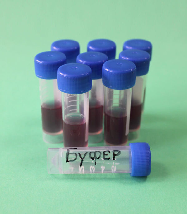 Молочнокислые бактерии – польза или вред? Молочнокислые бактерии – польза или вред?