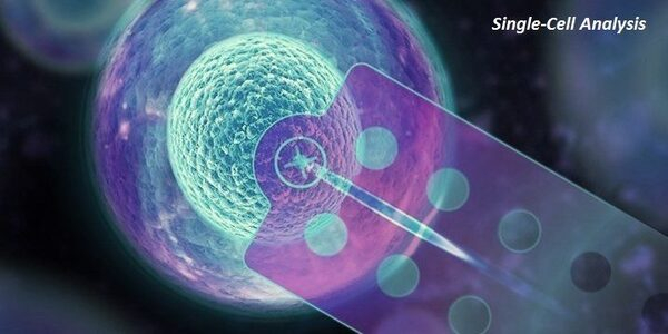 Single-Cell Analysis Market Insights, Share, Growth Drivers and Demand till 2022 Single-Cell Analysis Market Insights, Share, Growth Drivers and Demand till 2022