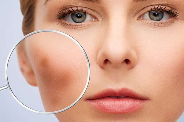 Мадина Байрамукова рассказала о последствиях самоизоляции для нашей кожи Мадина Байрамукова рассказала о последствиях самоизоляции для нашей кожи