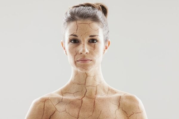 Владимир Плахотин рассказал о том, с чем связана обезвоженность кожи Владимир Плахотин рассказал о том, с чем связана обезвоженность кожи