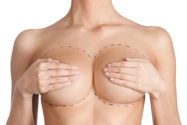 Владимир Плахотин: разворот импланта в груди – как не допустить подобной ситуации Владимир Плахотин: разворот импланта в груди – как не допустить подобной ситуации