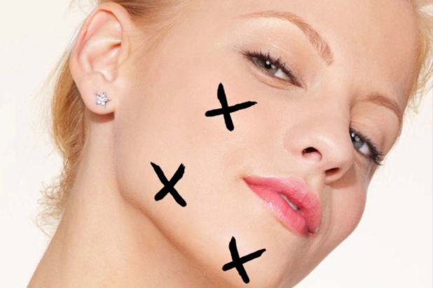 Лия Гавашели рассказала о причинах появления прыщей Лия Гавашели рассказала о причинах появления прыщей