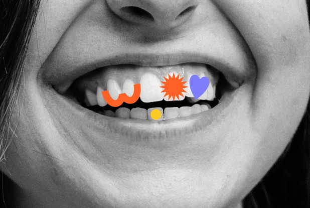 Владимир Лосев: украшения для зубов снова в моде Владимир Лосев: украшения для зубов снова в моде